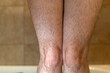 A woman's hairy legs 