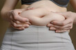 © GRON777 - A fat woman in white trousers touches the fat folds on her stomach, close-up.Lifestyle,diet concept,weight loss,obesity.