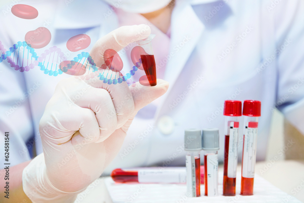 DNA testing of the blood in the laboratory with blood sample collection ...