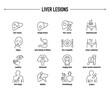 © missbobbit - Liver Lesions symptoms, diagnostic and treatment vector icon set. Line editable medical icons.