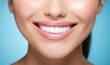 © Neural Pixels - Beautiful wide smile of healthy woman, white teeth close up, dentist tooth whitening. Generative AI