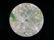 trichuris trichiura egg human parasite in stool or faeces examination test find microscope