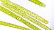 Leinwandbild Motiv Freshwater microalgae (Pleurotaenium sp.) blooming under microscope. 760x magnification. Sampel was taken on July 8, 2023 (dry season). Location: Bogor regency, Indonesia