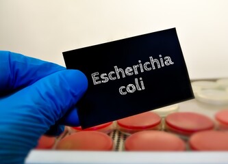 Poster - Escherichia coli bacteria. medical and healthcare conceptual image.