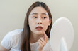 © KMPZZZ - Expression worry asian young woman hand touching pustule around the chin and mouth, allergic when wear mask, makeup, show squeezing pimple spot from face. Beauty care, skin problem by acne treatment.