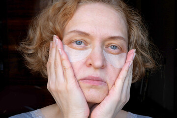 middle aged female's eye with drooping eyelid with patch for eyes. ptosis is a drooping of the upper