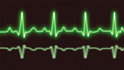 Wall Mural - Cardiogram cardiograph oscilloscope screen Green. Glowing neon green heart monitor line with moving background. Heart rate monitor electrocardiogram EKG or ECG background.