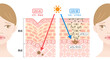 紫外線　UVAとUVB　女性と肌の断面図　