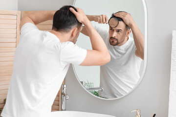 Wall Mural - Handsome man with hair loss problem and magnifier looking in mirror at home