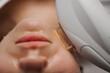 © callisto - Phototherapy, photorejuvenation, IPL in a beauty salon. Care for a woman's face.