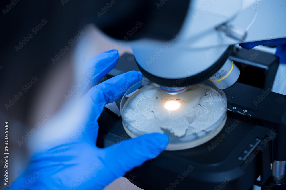 Scientist holding agar plate for diagnosis bacterial or microorganism ...