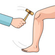 The doctor checks patellar reflex with a hammer diagram schematic vector illustration. Medical science educational illustration