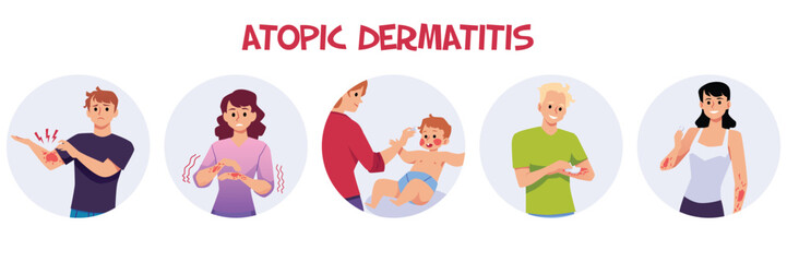 Set of people with atopic dermatitis flat style, vector illustration