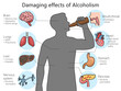 harmful effects of alcohol on the human body diagram schematic vector illustration. Medical science educational illustration