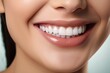 © twilight mist - Beautiful cute smile with very clean perfect teeth
