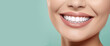 © Mirador - Closeup of Beautiful Smiling Woman with White Teeth on Mint Background