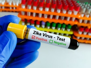 Sticker - Blood sample for Zika virus test