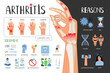 Rheumatoid arthritis vector medical poster. Symptoms treatment reasons of the disease. Medical infographic set with icons and other elements