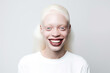 portrait of smiling young black albino woman with blond hair, ai generated