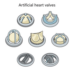 Canvas Print - Artificial heart valve implant in human heart diagram schematic vector illustration. Medical science educational illustration