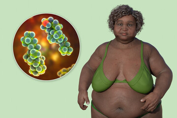 Poster - An overweight woman with a close-up view of cholesterol molecules, 3D illustration