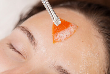 Performing carboxy therapy procedure for a female client in cosmetology clinic. Applying special gel with brush for injection of carbon dioxide under the skin, carboxytherapy