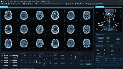 Aufkleber - 3D Render: Magnetic Resonance Imaging Brain Scan Mock-up with Multiple Windows and Data. Professional Medical Research Software Template with MRI Results for Computer Displays and Laptop Screens.