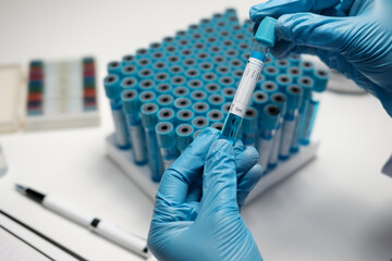 Wall Mural - Scientist hand taking a sample tube from a rack with machines of analysis in the lab background, Technician holding tube test in the research laboratory.