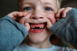 © Amanda Voelker/Stocksy - Lost Front Teeth