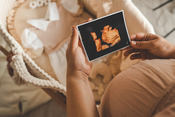 Wall Mural - Ultrasound picture pregnant baby photo. Woman holding ultrasound pregnancy image. Concept of pregnancy, maternity, expectation for baby birth