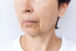 © Марина Демешко - The lower part of elderly woman's face and neck with signs of skin aging isolated on a white background. Age-related changes, flabby sagging facial skin, wrinkles and creases. Aging process