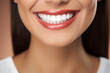 © Tetiana - Generative AI concept close up cropped photo of woman mouth with perfect white bright smile and healthy teeth