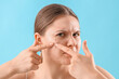 Teenage girl with acne problem squishing pimple on blue background, closeup