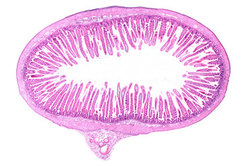 Poster - Small intestine. Villi