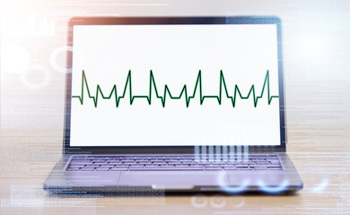 Poster - Laptop, software and screen, code and EKG, information technology with heartbeat and cybersecurity programming. Dashboard, update and tech health, safety and coding, graph and data protection overlay