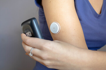 female hand with continuous glucose monitor doing reading from the arm patch