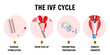 In vitro fertilization process IVF infographics and illustrations with steps 
