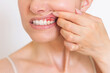 © Ольга Шефер - a close-up photo of a young Caucasian woman who shows off her red gums on the upper jaw, suffers from gum inflammation. Dental care. Dentistry
