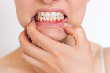 a close-up photo of a young woman who shows inflamed red bleeding gums isolated on a white background. Dentistry. Gum disease