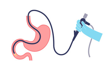 Poster - esophagogastroduodenoscopy medical procedure