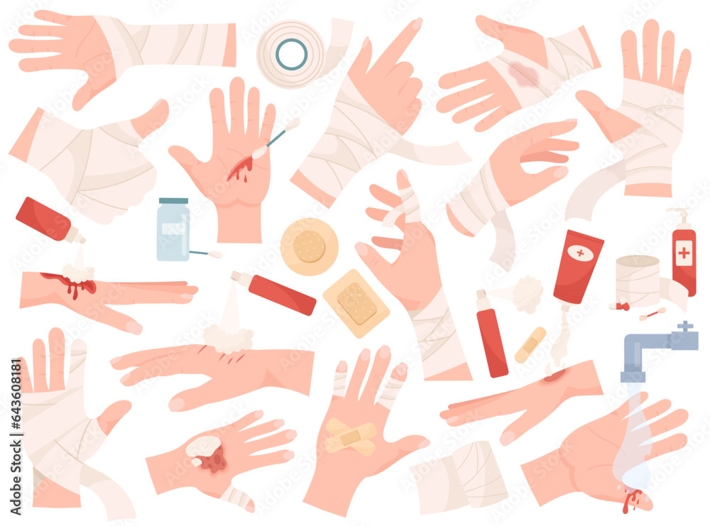 Scrape Hand Hands with injured skin, different sprain, fracture and trauma with ...