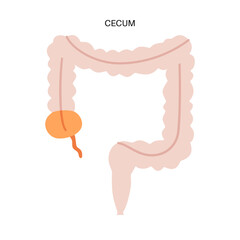 Wall Mural - Large intestine anatomy