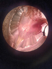 Inthanin ovule