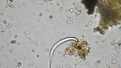 Wall Mural - Fungal and fungi hyphae under the microscope in the soil and compost, in a soil biology and microorganism test