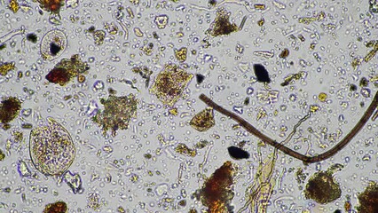 Wall Mural - Fungal and fungi hyphae under the microscope in the soil and compost, in a soil biology and microorganism test