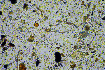 Wall Mural - soil life under the microscope with soil fungi and fungal hyphae