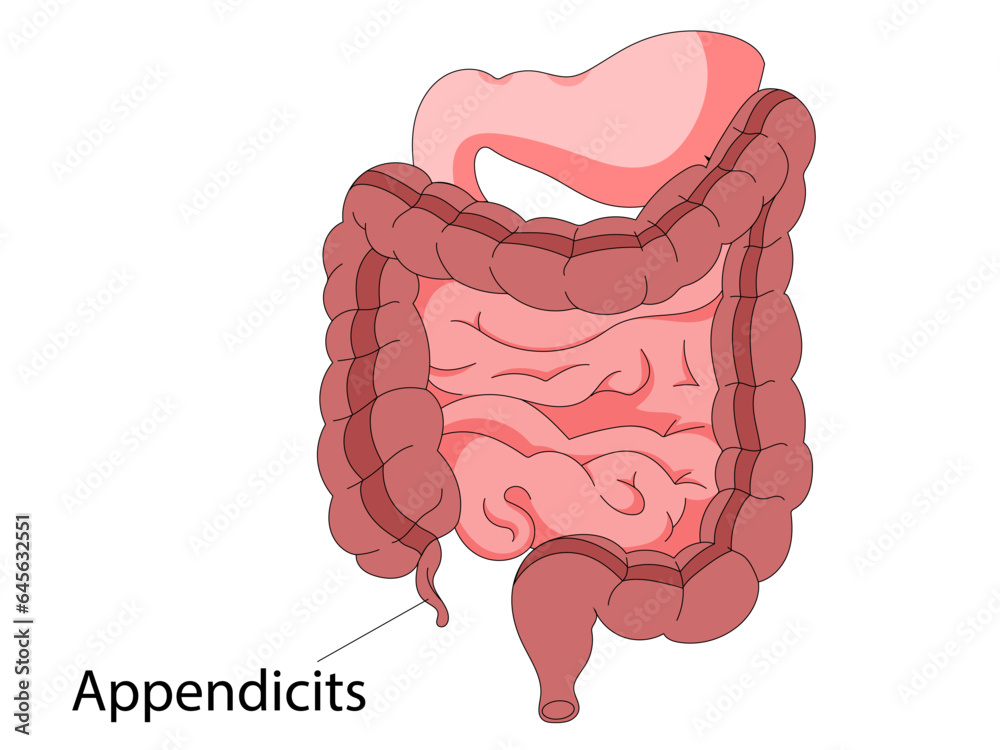 Human intestines anatomy . Abdominal cavity digestive and excretion ...