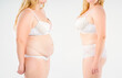 Tummy tuck, woman's fat body before and after weight loss and liposuction on light gray background, plastic surgery concept
