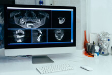Х-ray Image Of A Computer In A Dentist's Office