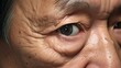 Skin creases around the eye of Asian elder man, Generative AI